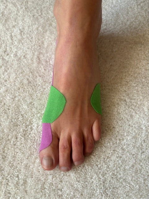 Hallux valgus verstehen (Online Workshop)